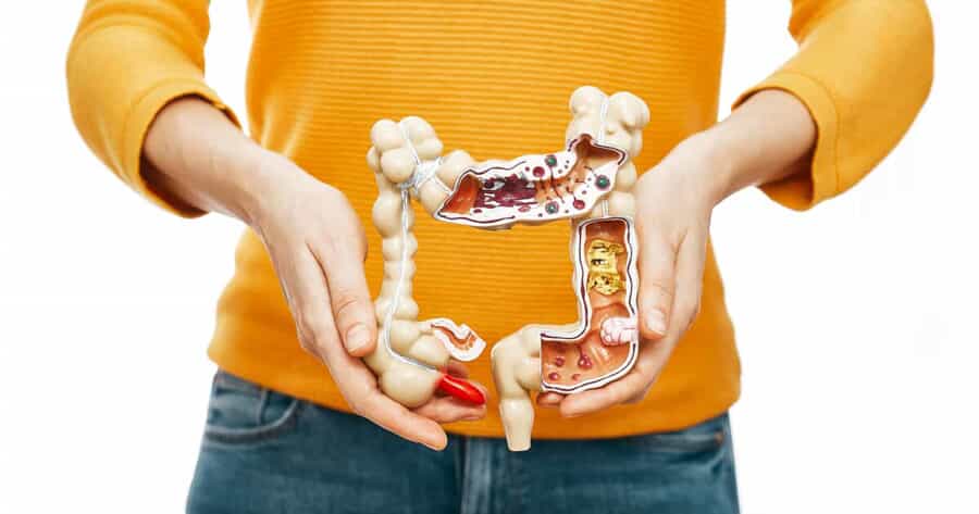 Colon Health Image