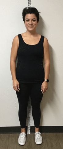 Danielle Deuell 1 year after bypass