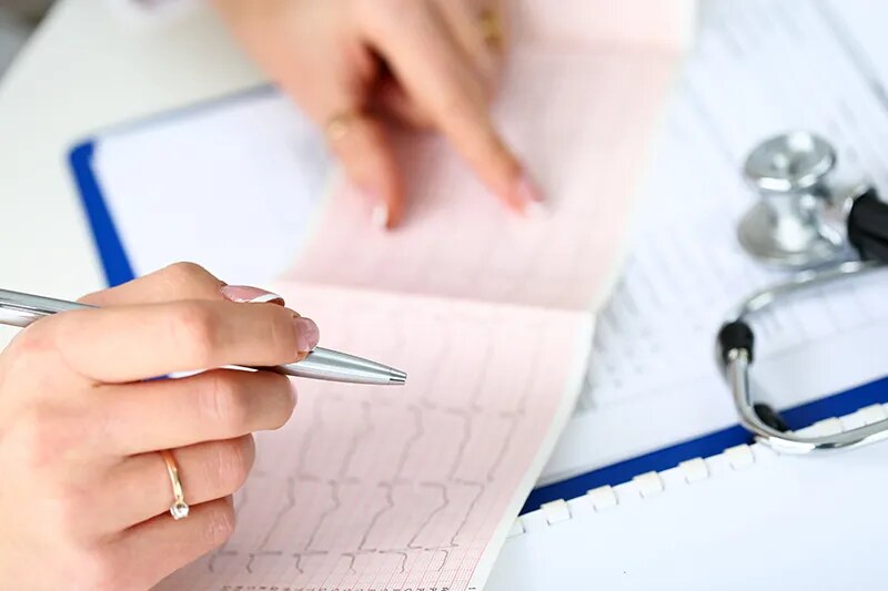 doctor review cardiogram