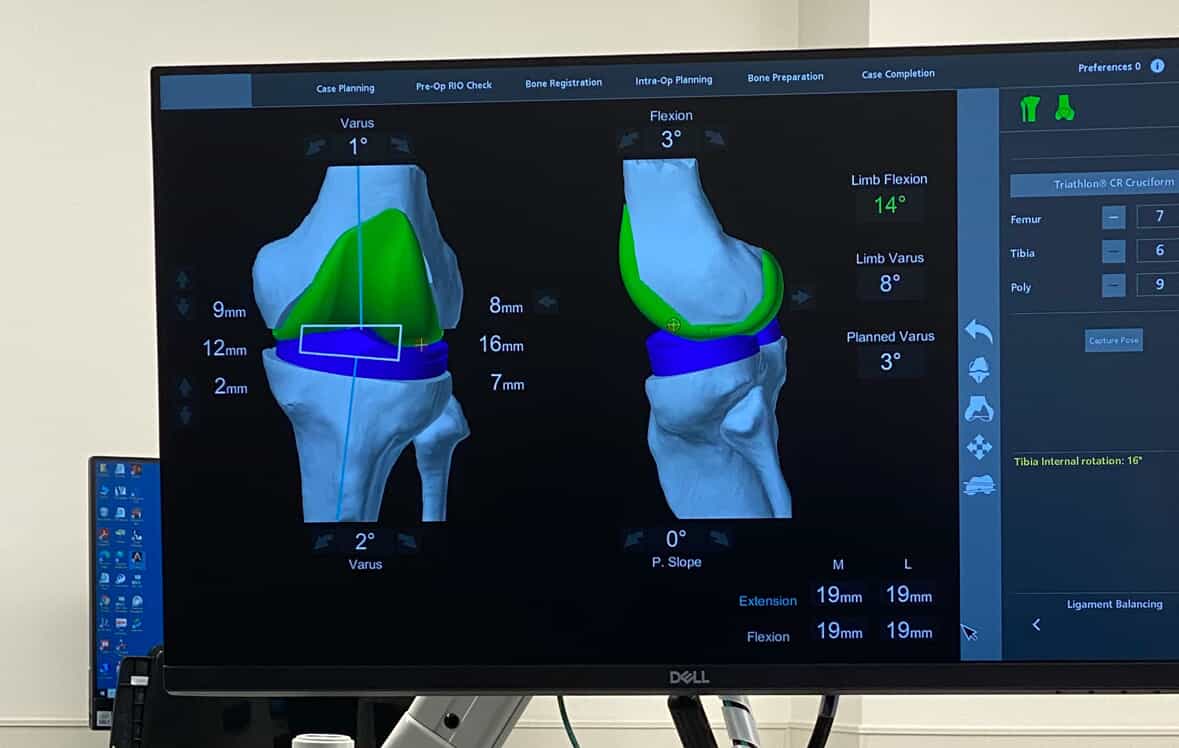 surgical planning interface monitor